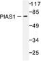 Gbp antibody, LS-C176341, Lifespan Biosciences, Western Blot image 