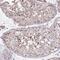 Meiotic Double-Stranded Break Formation Protein 1 antibody, HPA049240, Atlas Antibodies, Immunohistochemistry paraffin image 