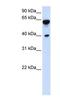 Dystrobrevin beta antibody, NBP1-56492, Novus Biologicals, Western Blot image 