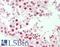 Menin 1 antibody, LS-B11279, Lifespan Biosciences, Immunohistochemistry paraffin image 