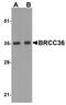 BRCA1/BRCA2-Containing Complex Subunit 3 antibody, NBP1-76831, Novus Biologicals, Western Blot image 