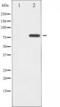 BMX Non-Receptor Tyrosine Kinase antibody, TA325277, Origene, Western Blot image 