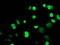 Myocyte Enhancer Factor 2C antibody, M01131-1, Boster Biological Technology, Immunofluorescence image 