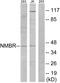 Neuromedin B Receptor antibody, GTX87422, GeneTex, Western Blot image 