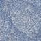 Mesothelin antibody, HPA017172, Atlas Antibodies, Immunohistochemistry frozen image 