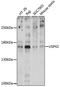 Ubiquitin Specific Peptidase 42 antibody, 16-318, ProSci, Western Blot image 
