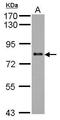 Potassium Channel Tetramerization Domain Containing 3 antibody, GTX120229, GeneTex, Western Blot image 