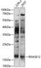 Ribonuclease A Family Member 12 (Inactive) antibody, 15-628, ProSci, Western Blot image 