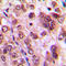 Akt antibody, LS-C354245, Lifespan Biosciences, Immunohistochemistry frozen image 