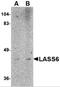 LAG1 longevity assurance homolog 6 antibody, 4941, ProSci, Western Blot image 