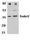 Endonuclease G, mitochondrial antibody, orb74478, Biorbyt, Western Blot image 