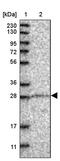 Zinc Finger MYND-Type Containing 19 antibody, PA5-54252, Invitrogen Antibodies, Western Blot image 