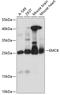 ER Membrane Protein Complex Subunit 8 antibody, GTX66298, GeneTex, Western Blot image 