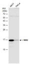 Neuromedin U antibody, GTX131391, GeneTex, Western Blot image 