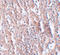 Zinc transporter ZIP5 antibody, A09389, Boster Biological Technology, Immunohistochemistry paraffin image 