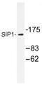 Zinc Finger E-Box Binding Homeobox 2 antibody, AP01369PU-N, Origene, Western Blot image 