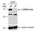 Calcium/Calmodulin Dependent Protein Kinase Kinase 2 antibody, NBP1-31247, Novus Biologicals, Western Blot image 