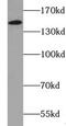 Xanthine Dehydrogenase antibody, FNab09539, FineTest, Western Blot image 