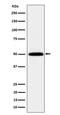 Histidyl-TRNA Synthetase antibody, M05242, Boster Biological Technology, Western Blot image 