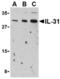 Interleukin 31 antibody, TA306294, Origene, Western Blot image 