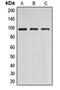 DNA Methyltransferase 3 Beta antibody, MBS822150, MyBioSource, Western Blot image 