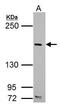 SET Domain Containing 2, Histone Lysine Methyltransferase antibody, PA5-34935, Invitrogen Antibodies, Western Blot image 