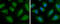 N-Acetyl-Alpha-Glucosaminidase antibody, GTX105504, GeneTex, Immunofluorescence image 