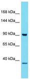 Hexokinase Domain Containing 1 antibody, TA331722, Origene, Western Blot image 