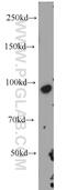Transferrin Receptor antibody, 10084-2-AP, Proteintech Group, Western Blot image 