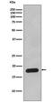 Peptidylprolyl Isomerase B antibody, M03229, Boster Biological Technology, Western Blot image 