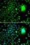 TATA-Box Binding Protein Associated Factor 5 antibody, orb373573, Biorbyt, Immunocytochemistry image 