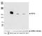 Platelet Derived Growth Factor Receptor Beta antibody, A700-107, Bethyl Labs, Western Blot image 