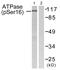 Probable cation-transporting ATPase 13A2 antibody, PA5-38261, Invitrogen Antibodies, Western Blot image 