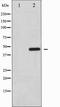 PTPN1 antibody, TA327798, Origene, Western Blot image 