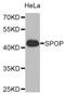 Speckle-type POZ protein antibody, orb373654, Biorbyt, Western Blot image 