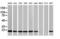 NADH:Ubiquinone Oxidoreductase Subunit B9 antibody, LS-C793248, Lifespan Biosciences, Western Blot image 