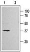 Potassium Voltage-Gated Channel Subfamily J Member 11 antibody, TA328935, Origene, Western Blot image 