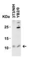 Barrier-to-autointegration factor antibody, 4019, ProSci, Western Blot image 