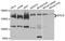 Epidermal Growth Factor Receptor Pathway Substrate 15 antibody, A9814, ABclonal Technology, Western Blot image 