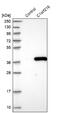 Chromosome 1 Open Reading Frame 216 antibody, NBP1-83469, Novus Biologicals, Western Blot image 