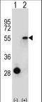 Estrogen Related Receptor Alpha antibody, LS-C167833, Lifespan Biosciences, Western Blot image 