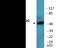 Myocyte Enhancer Factor 2C antibody, EKC2618, Boster Biological Technology, Western Blot image 