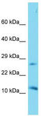 Death Associated Protein Like 1 antibody, TA331715, Origene, Western Blot image 