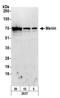 Menin 1 antibody, A300-106B, Bethyl Labs, Western Blot image 