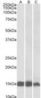 Fatty Acid Binding Protein 3 antibody, STJ72972, St John