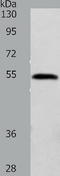 Rho GDP-dissociation inhibitor 1 antibody, TA323161, Origene, Western Blot image 