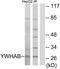Tyrosine 3-Monooxygenase/Tryptophan 5-Monooxygenase Activation Protein Beta antibody, TA312477, Origene, Western Blot image 