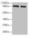 Diamine acetyltransferase 1 antibody, CSB-PA02754A0Rb, Cusabio, Western Blot image 