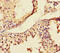Mme antibody, A54464-100, Epigentek, Immunohistochemistry paraffin image 