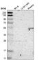 F-Box And Leucine Rich Repeat Protein 6 antibody, NBP2-58922, Novus Biologicals, Western Blot image 